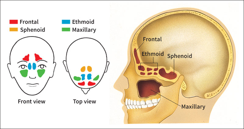 Location of the sinuses