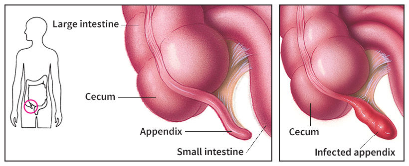 Appendix