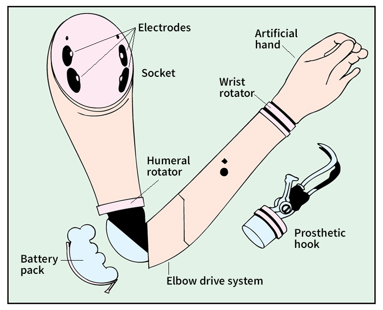 Myoelectric artificial arm