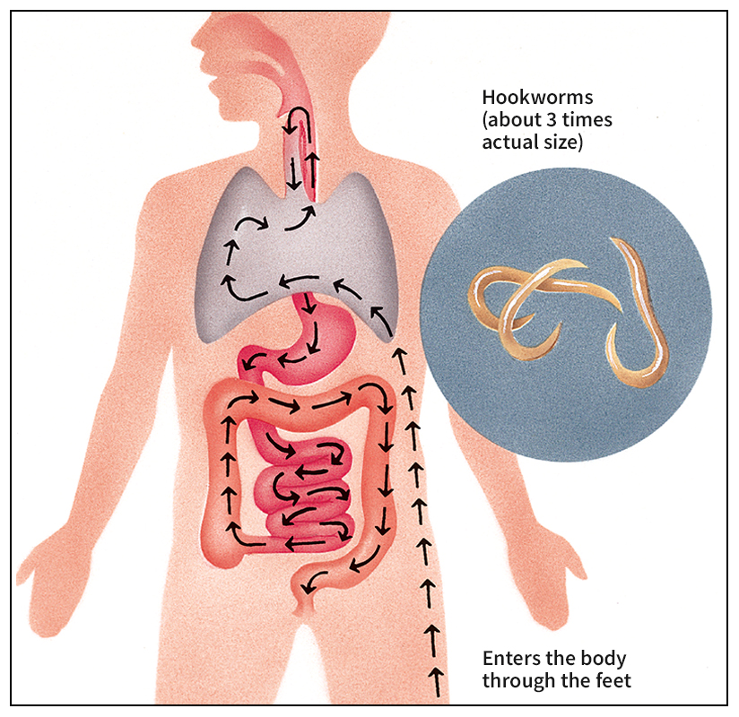 Path of a hookworm