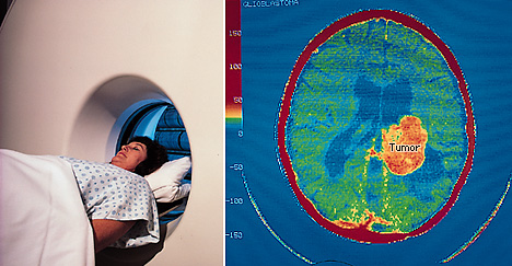 Computerized tomography (CT)