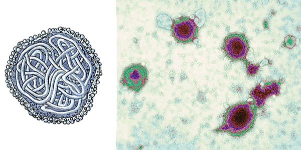 Measles virus