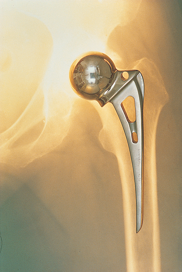 Replacement hip joint