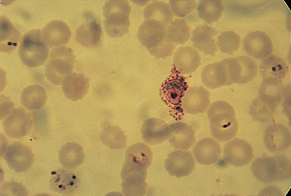 Plasmodium vivax