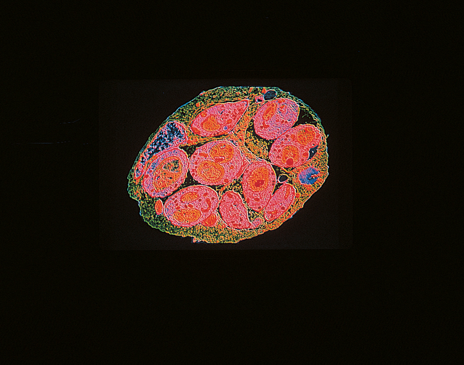 Apicomplexan