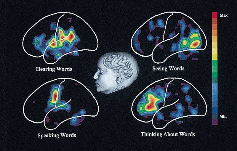 Positron emission tomography (PET)