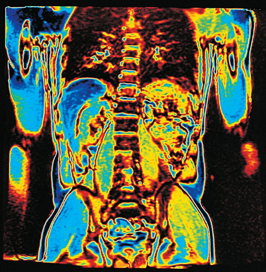 Computer graphic of MRI