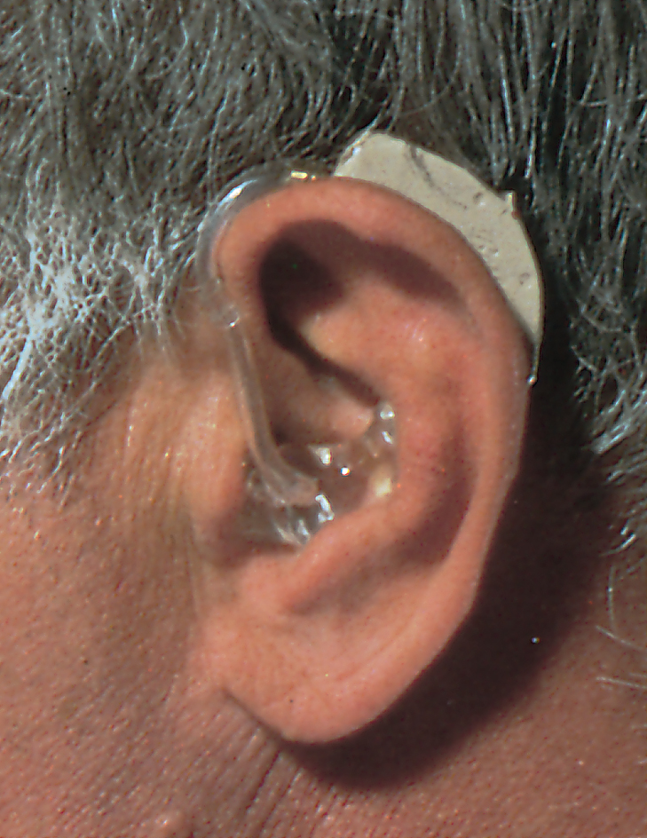 Behind-the-ear hearing aid