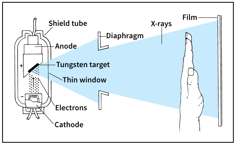 How an X-ray tube works