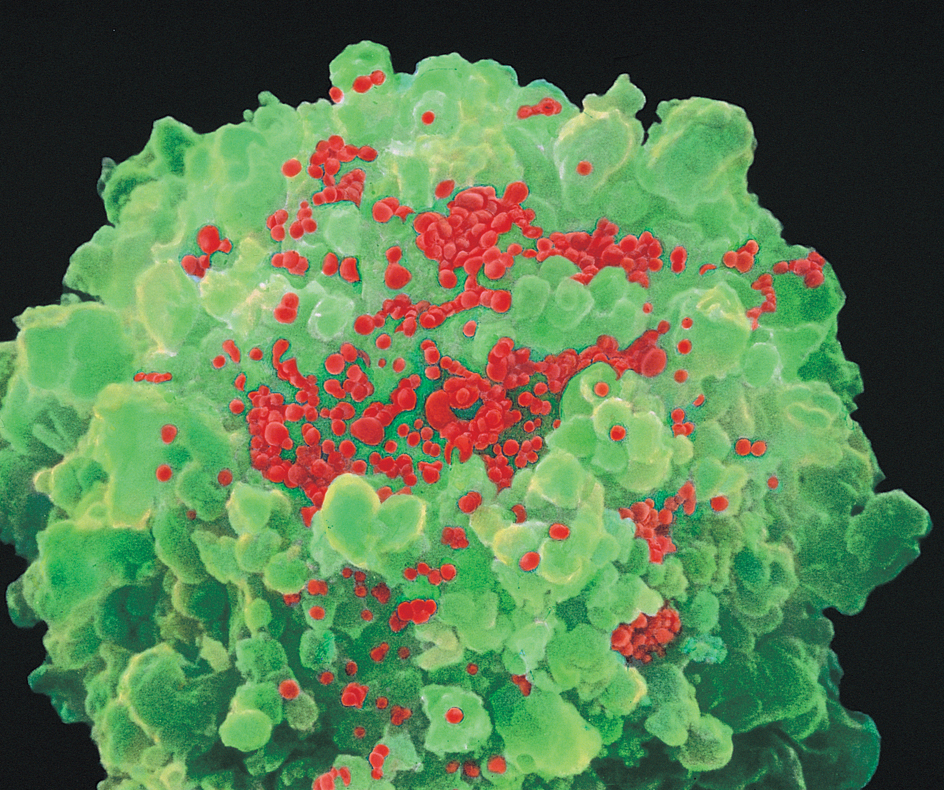 HIV virus