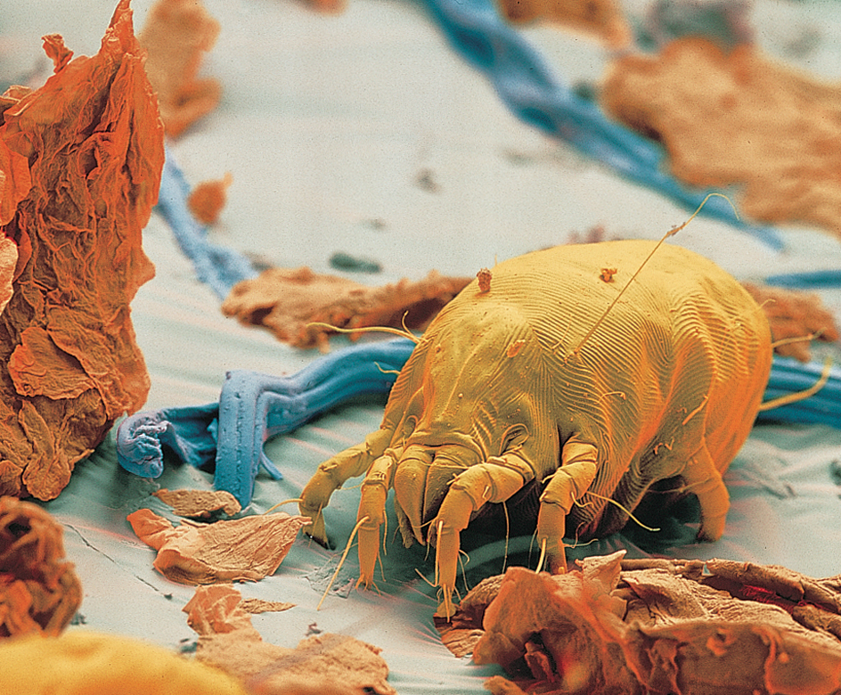 Dust mite