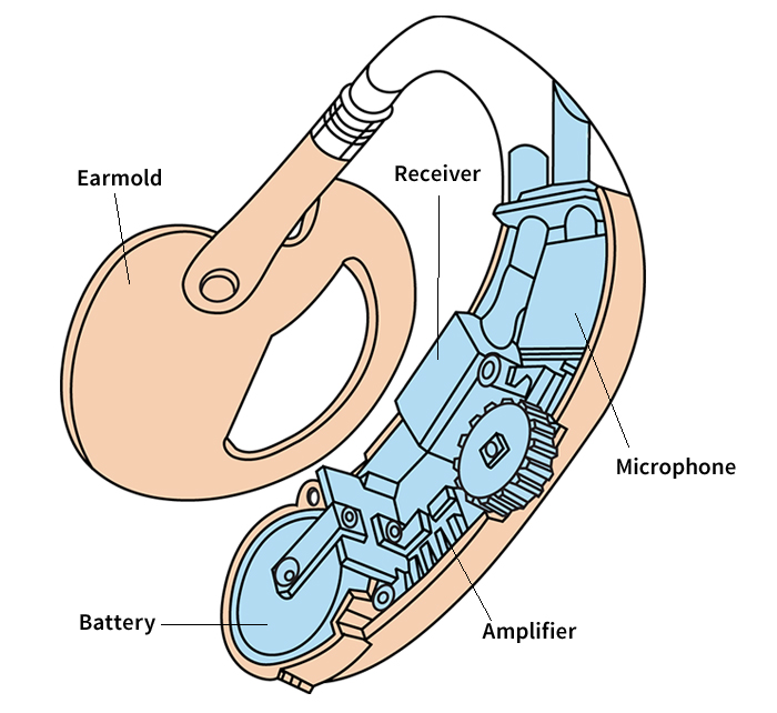 Main parts of a hearing aid