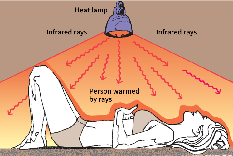 Radiation