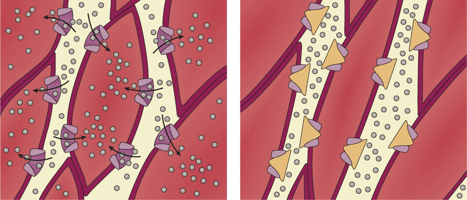 Calcium channel blocker