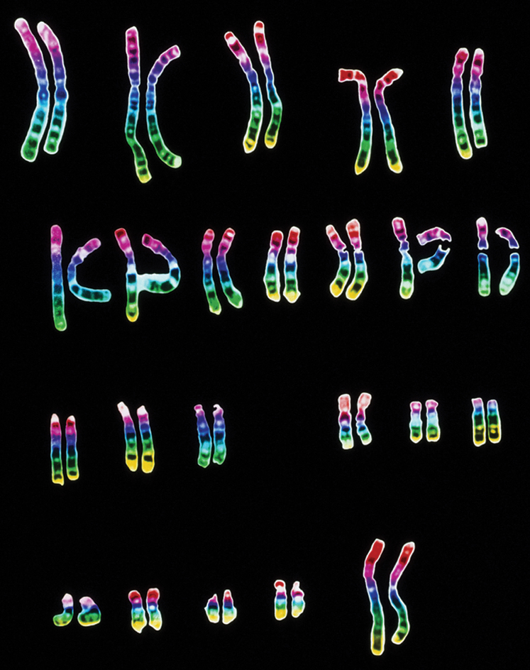 Human chromosomes