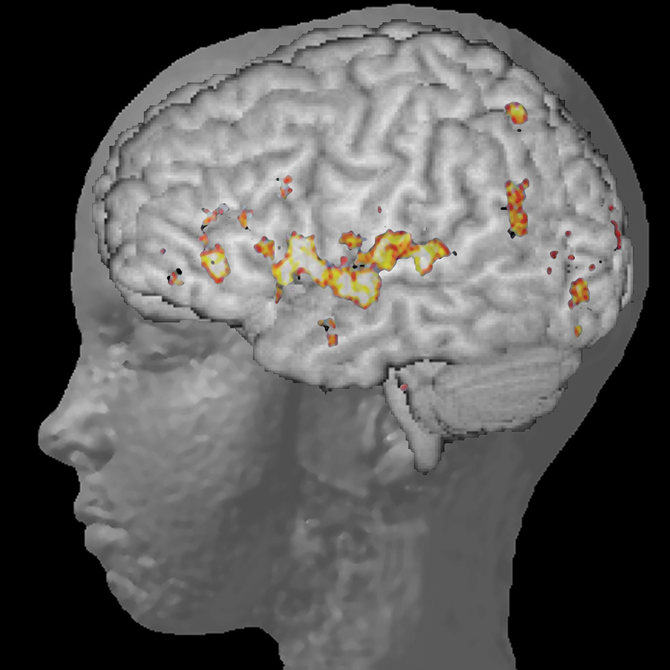 Functional MRI