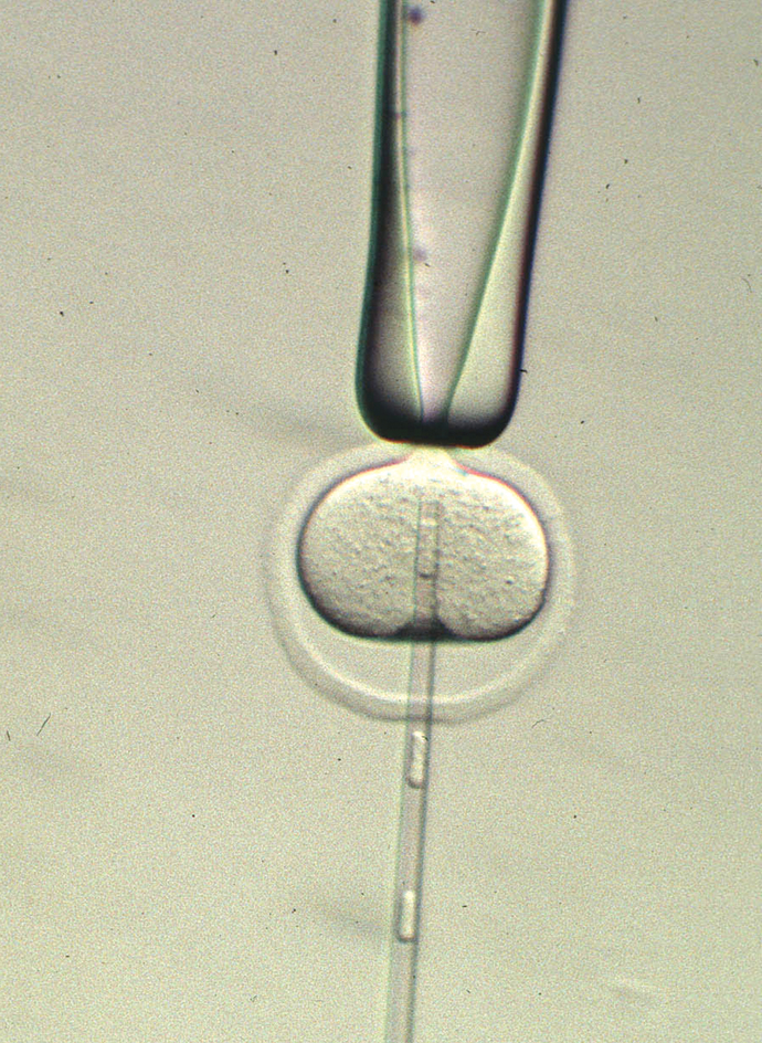 A nucleus being injected into an oocyte