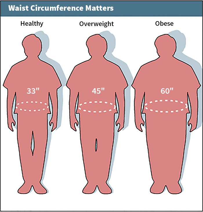 Waist circumference measuring obesity