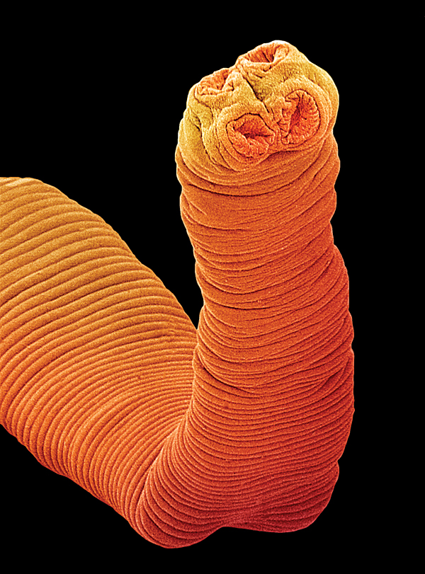 Head of a tapeworm