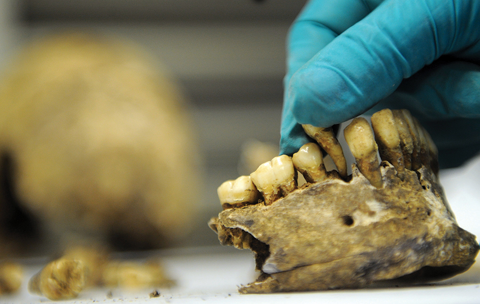 A forensic anthropologist examining a jawbone