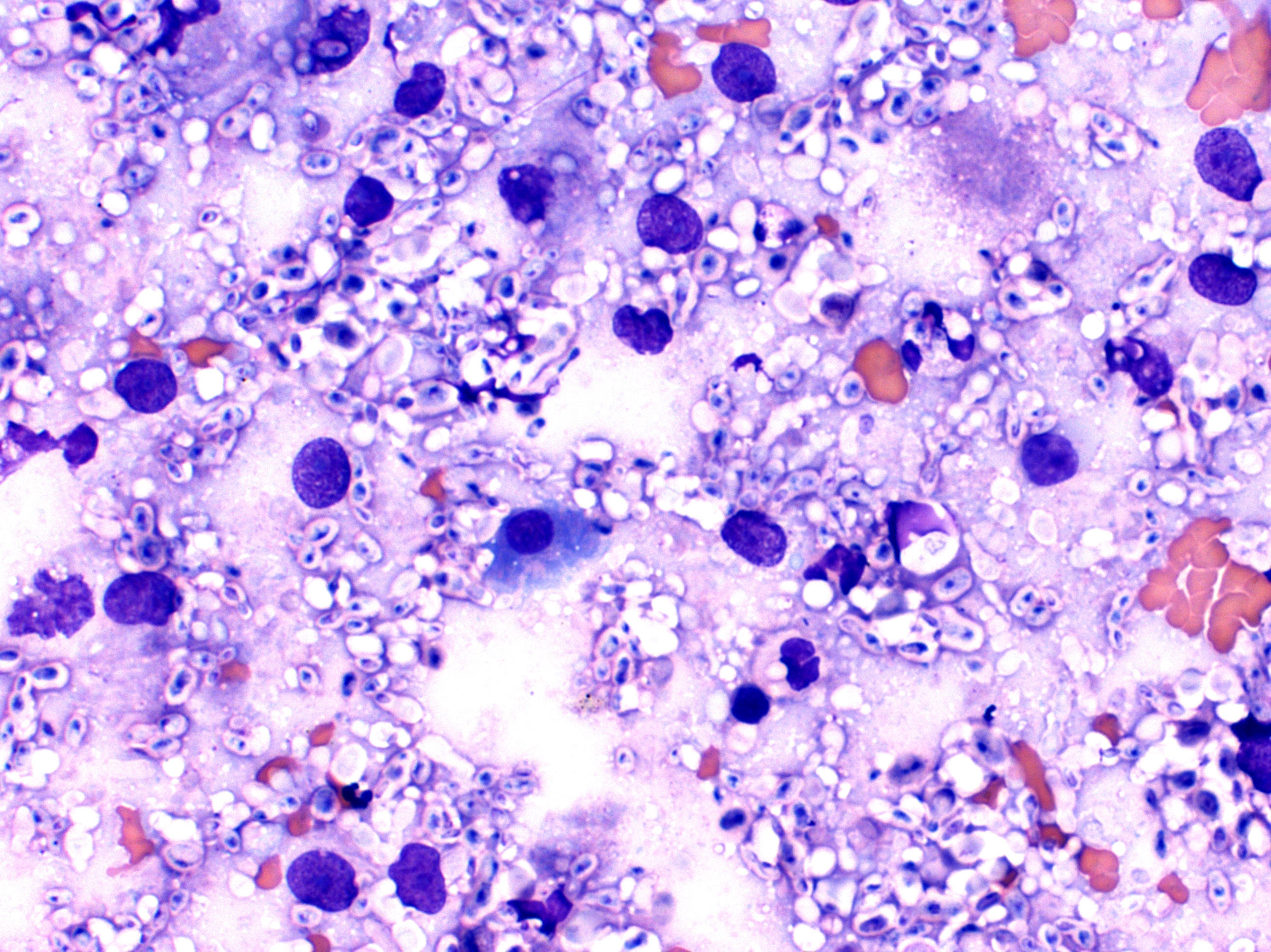 The fungus Cryptococcus, appearing as purple spots