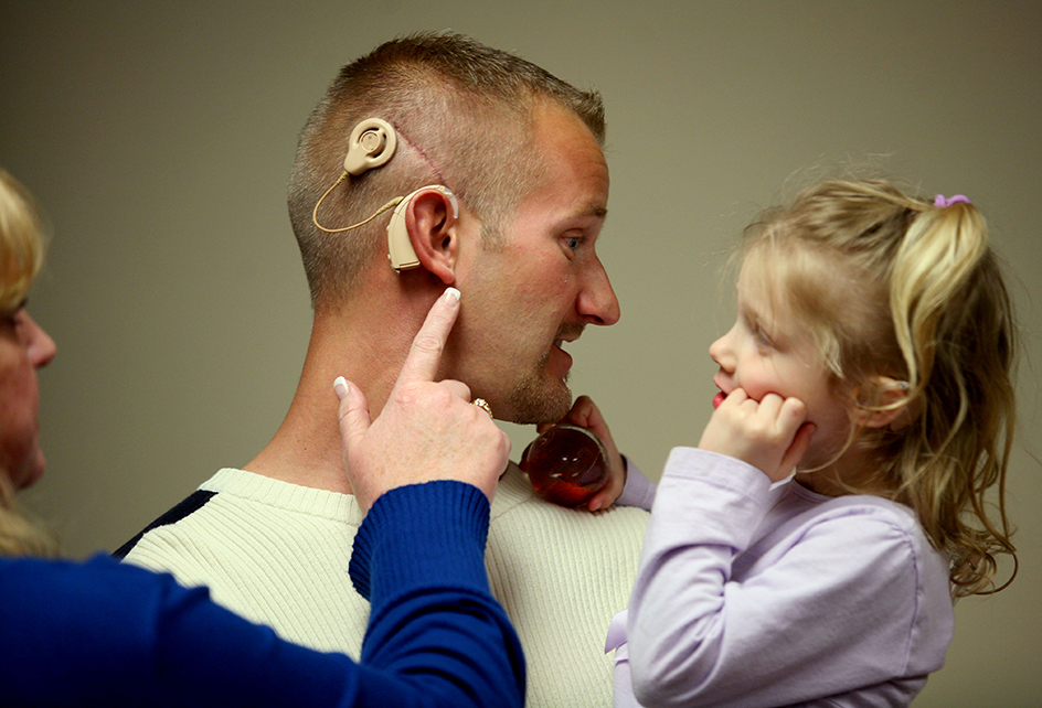 Cochlear implant