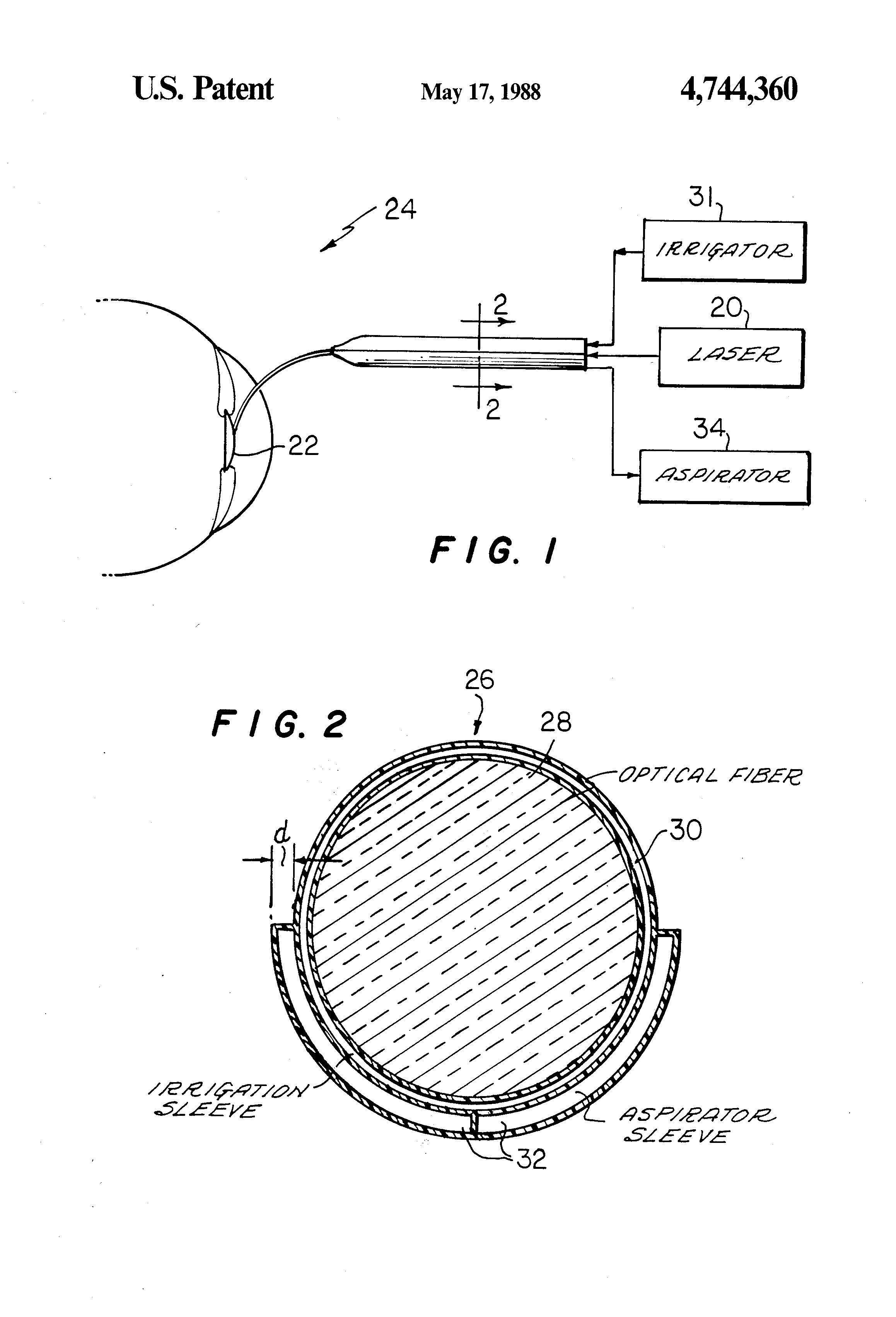 Patricia Bath patent