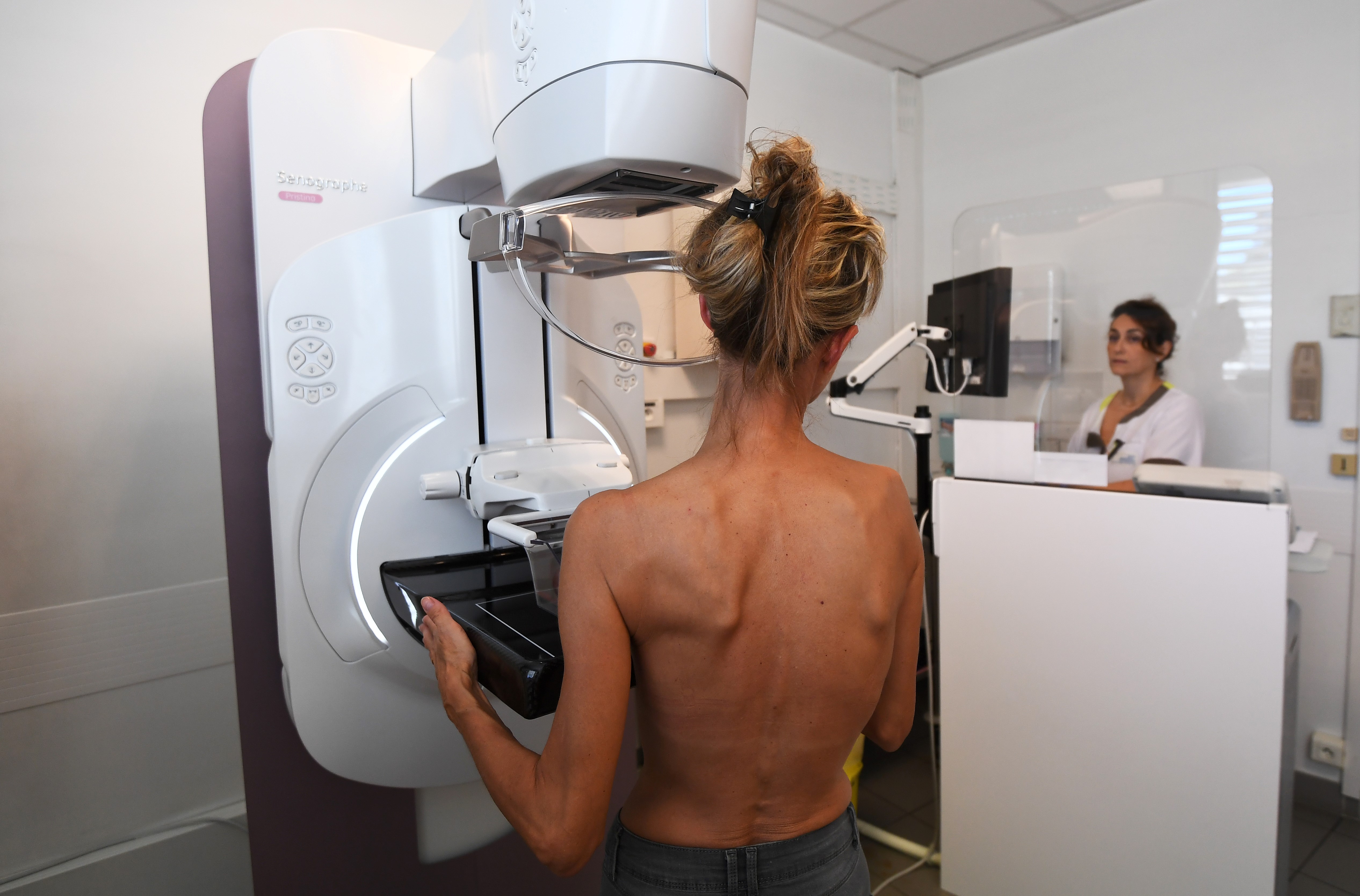 Mammography