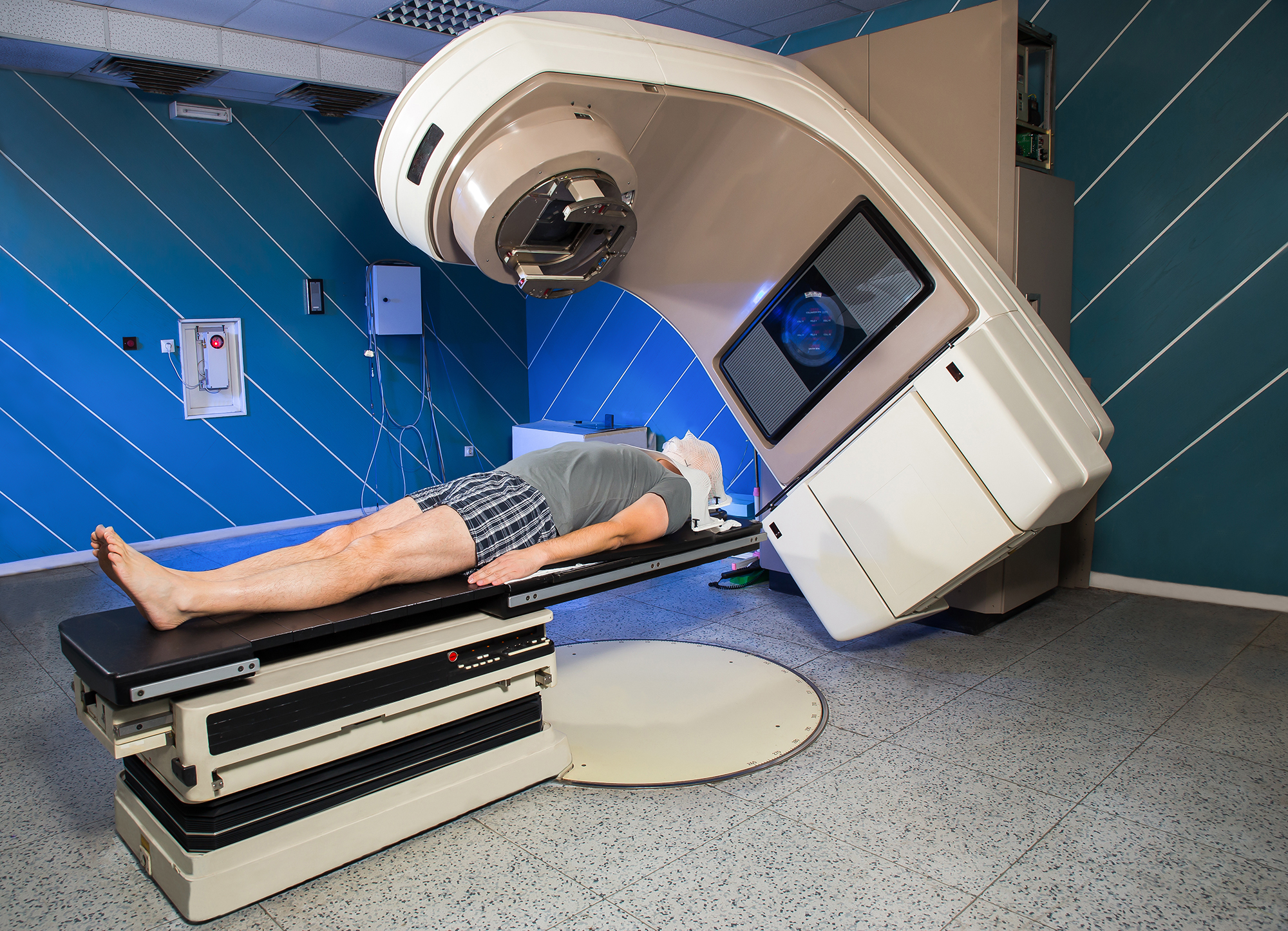 Radiation therapy for cancer