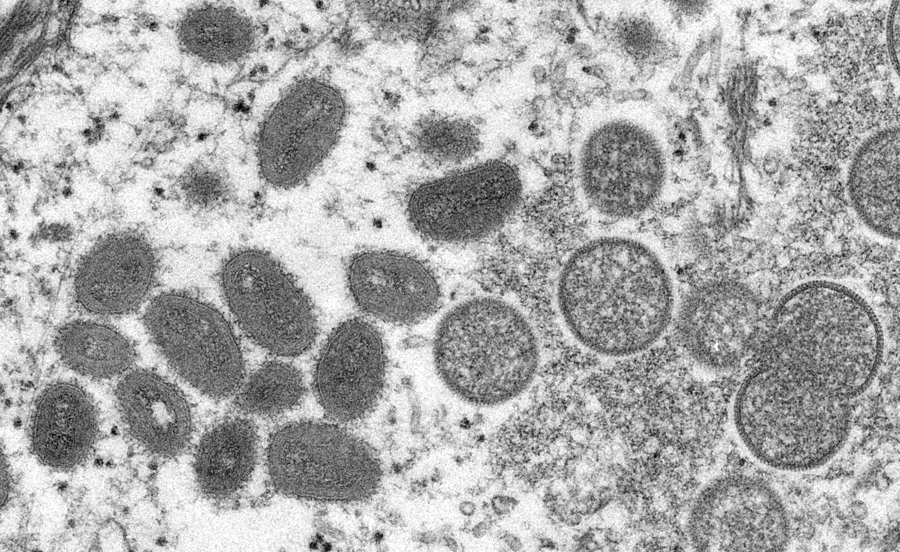 Microscope image of mpox virus collected during the 2003 outbreak