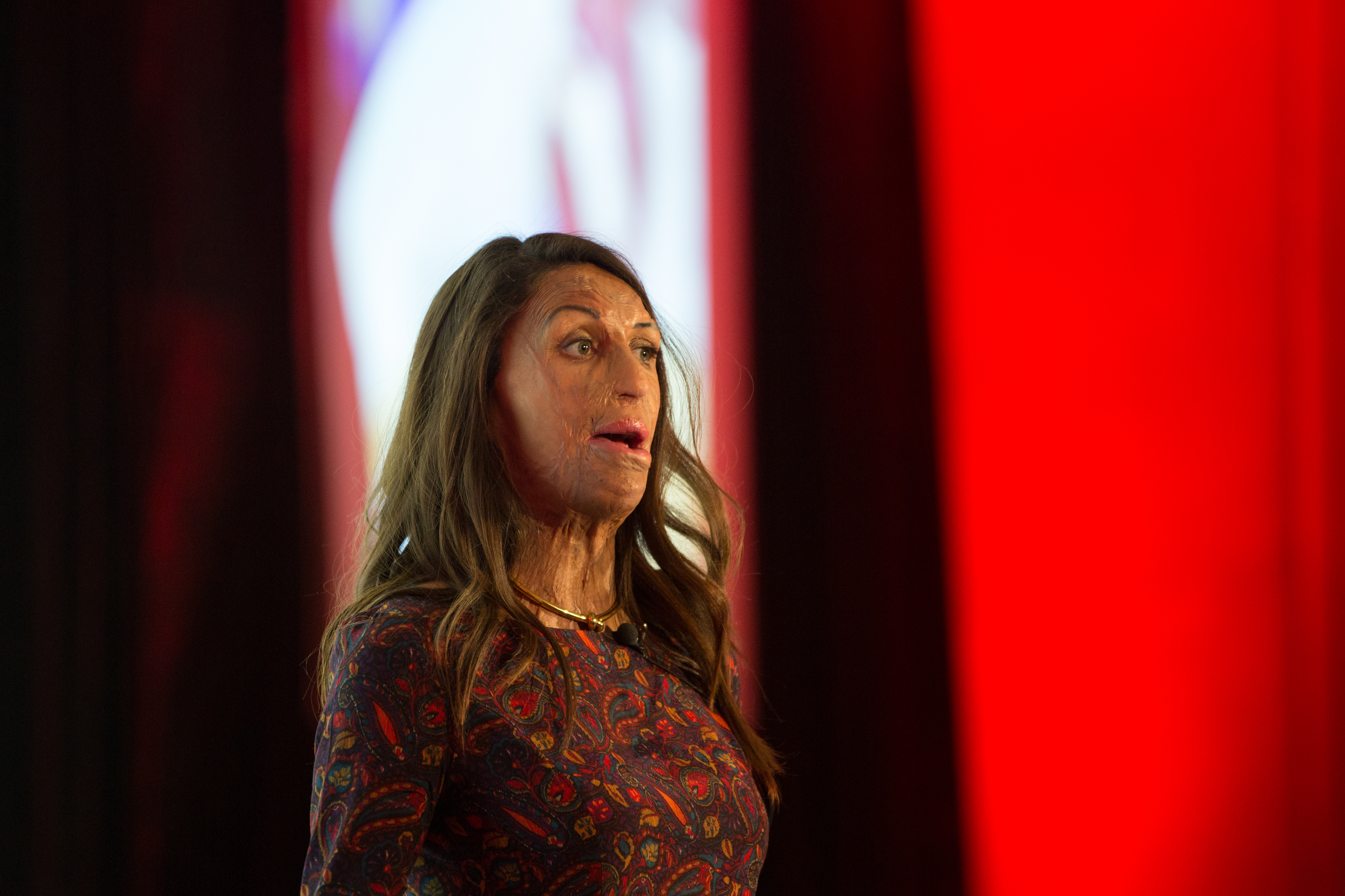 Australian motivational speaker Turia Pitt