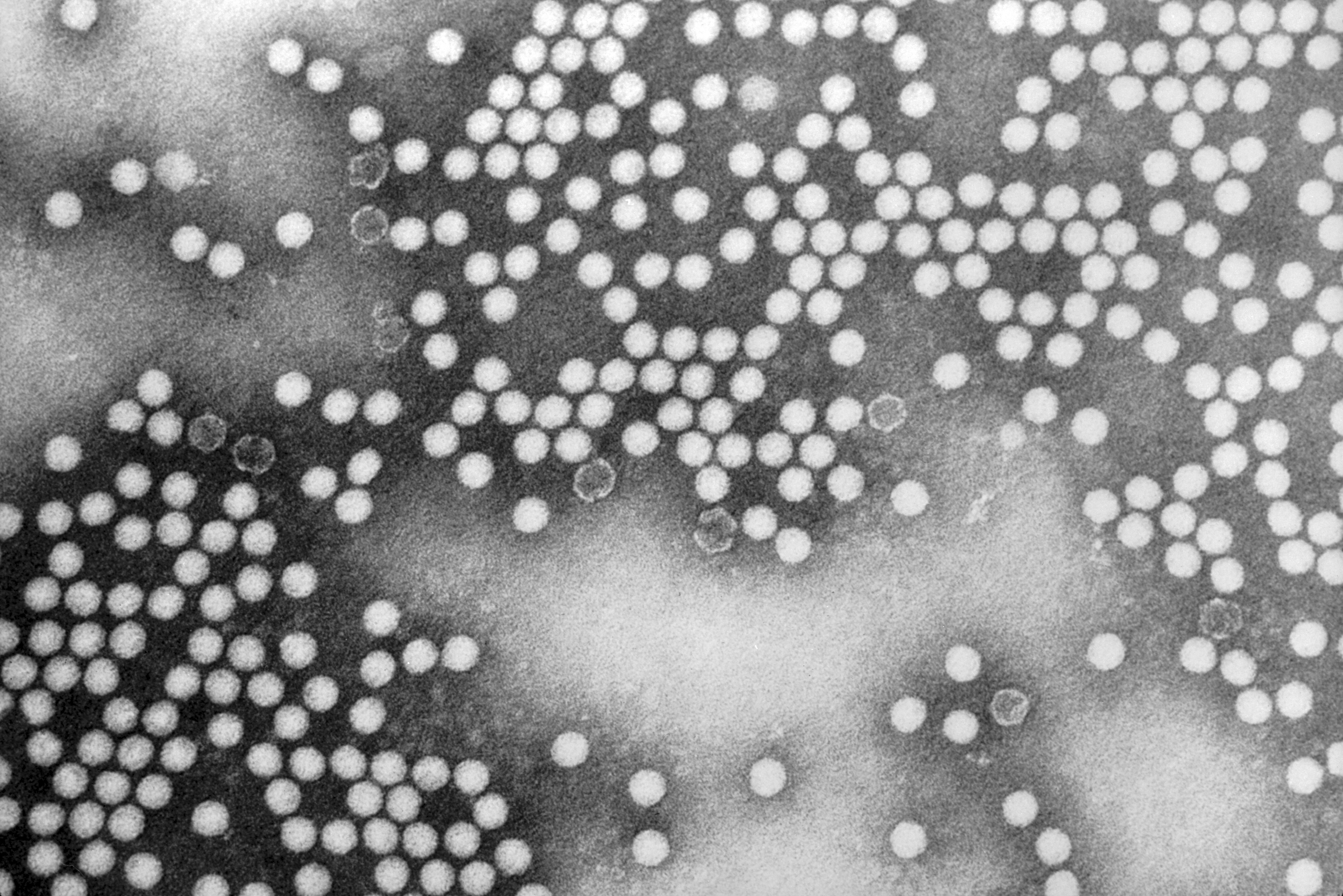 Poliovirus particles seen under a microscope