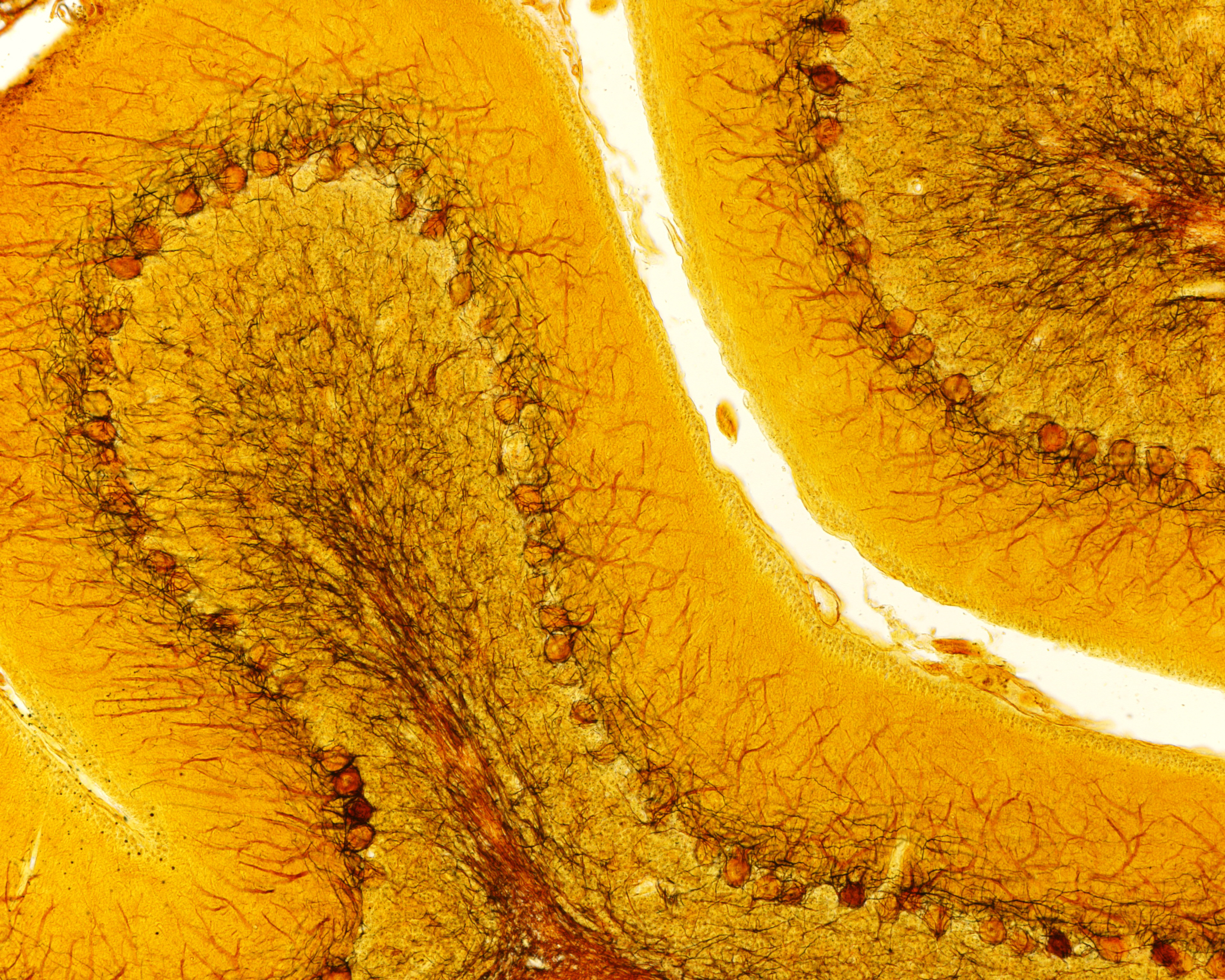 Microscope view of the brain showing Purkinjie cells