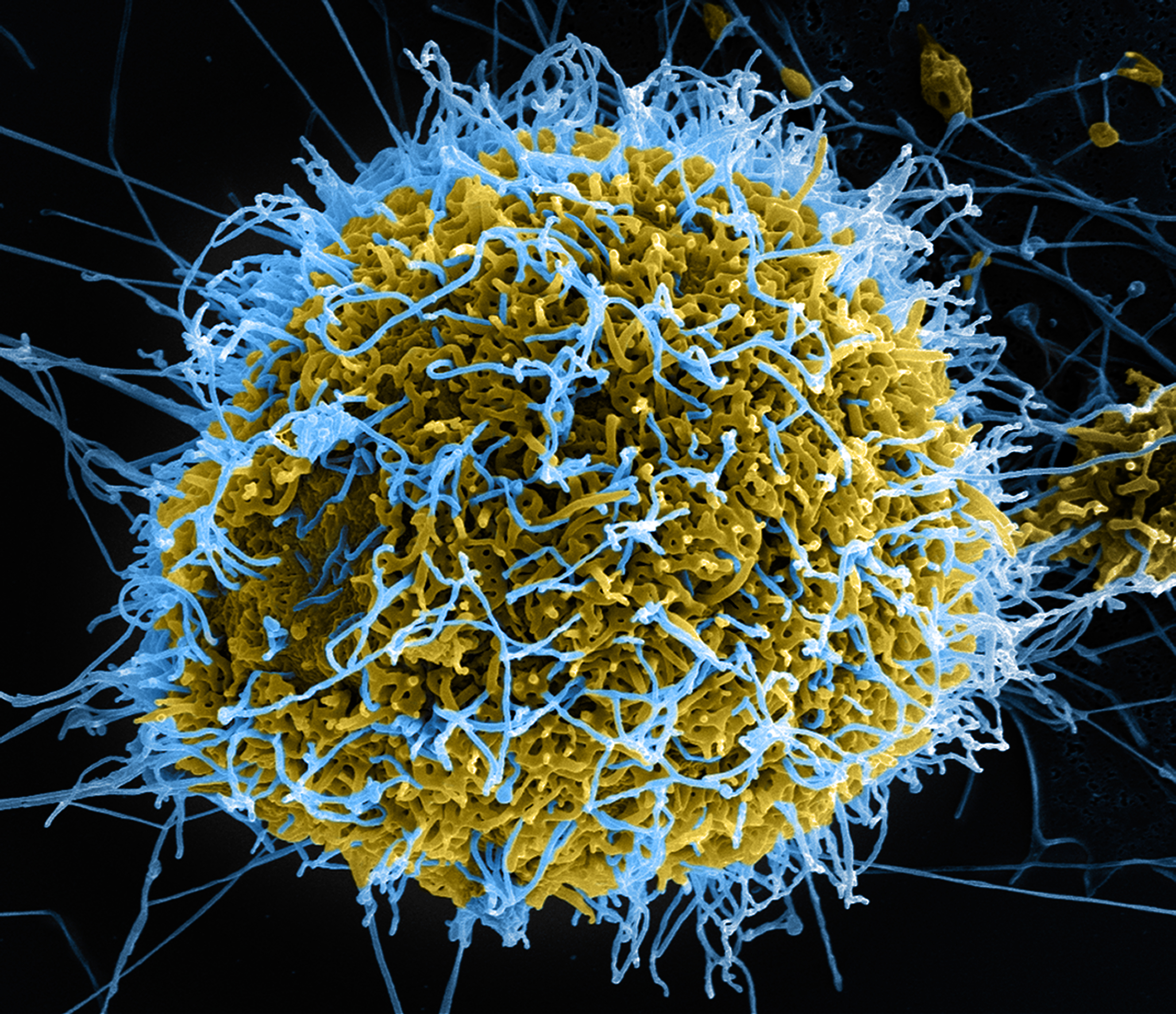 Stringlike particles of Ebola virus