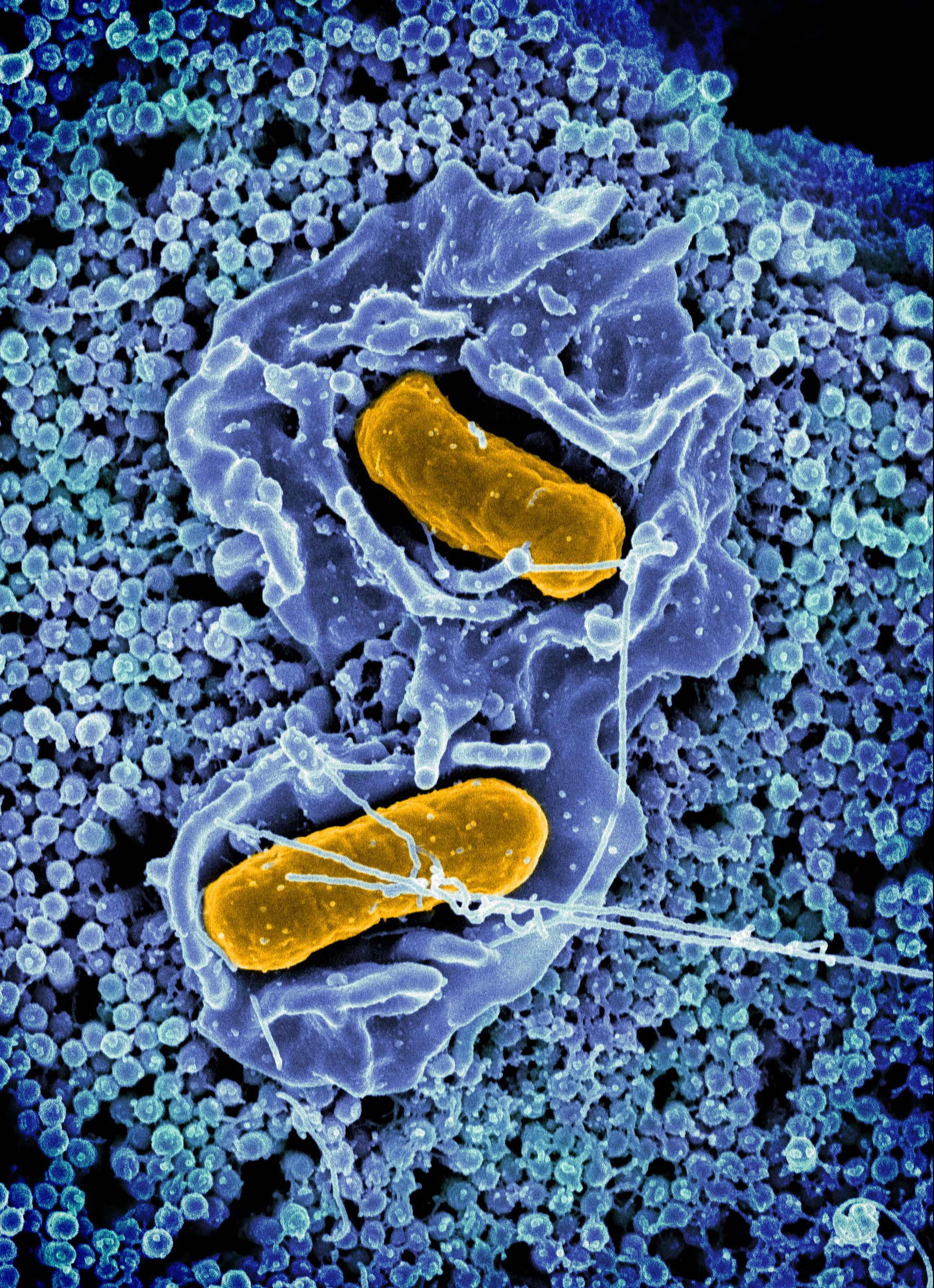 Salmonella bacteria invading a human cell