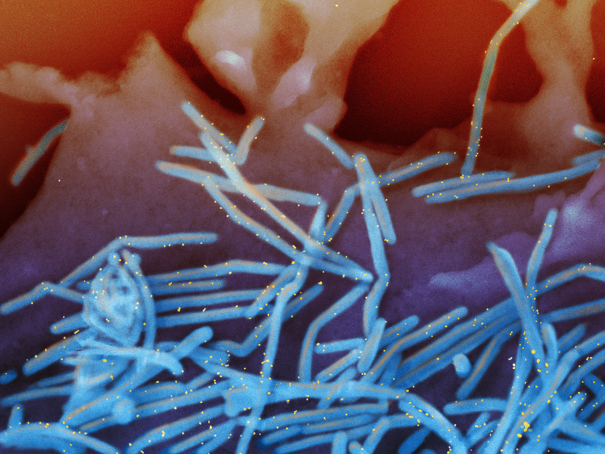 Respiratory syncytial virus (RSV) on human lung cells