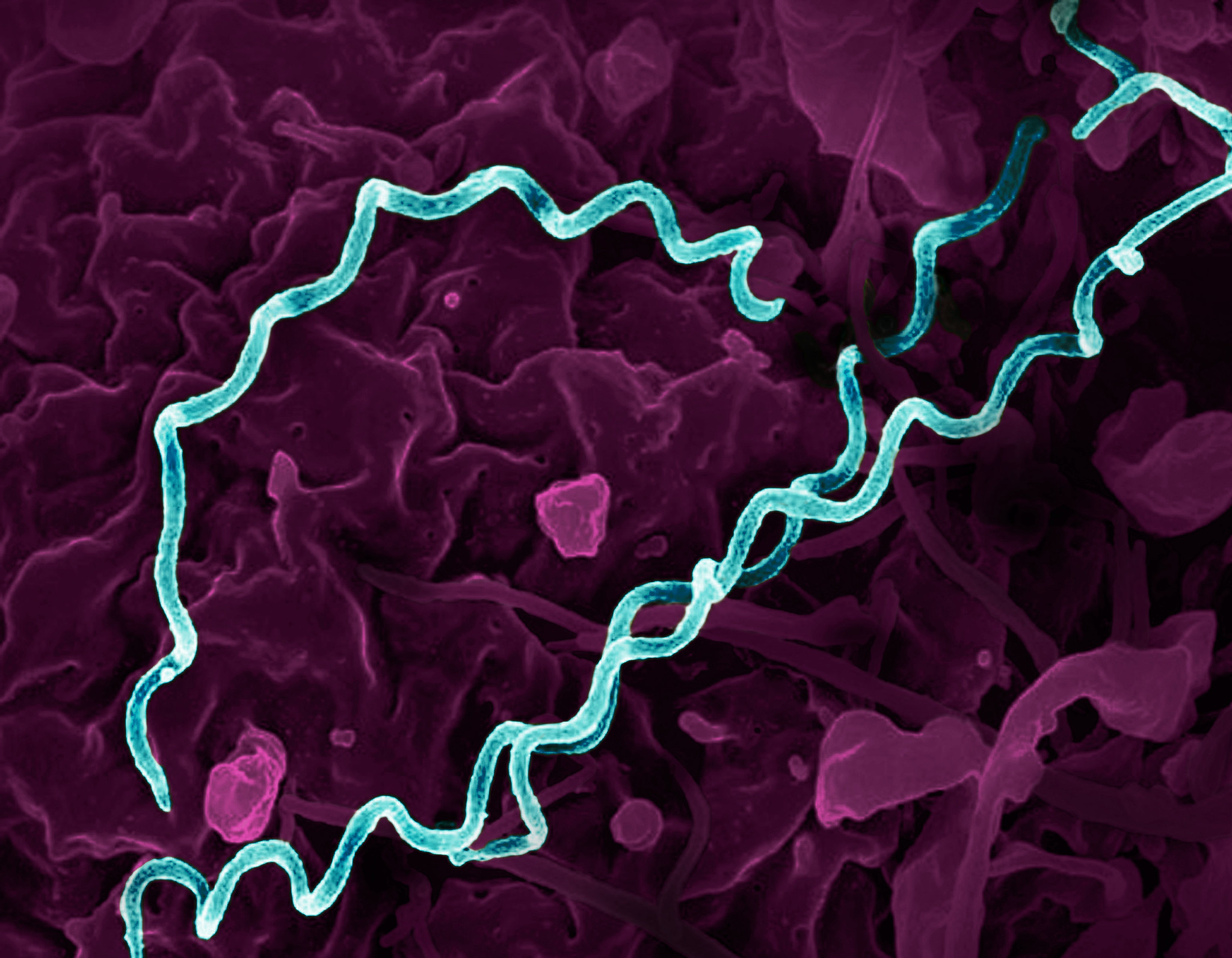 Spiral-shaped Treponema pallidum (syphilis) bacteria