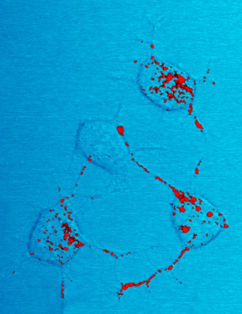 Nerve cells infected with prions