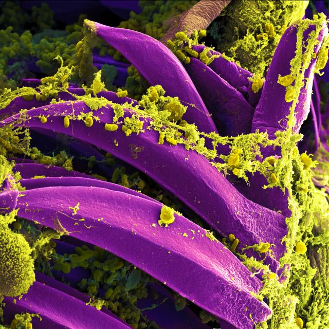 Yersinia pestis (plague) bacteria in a flea's digestive system