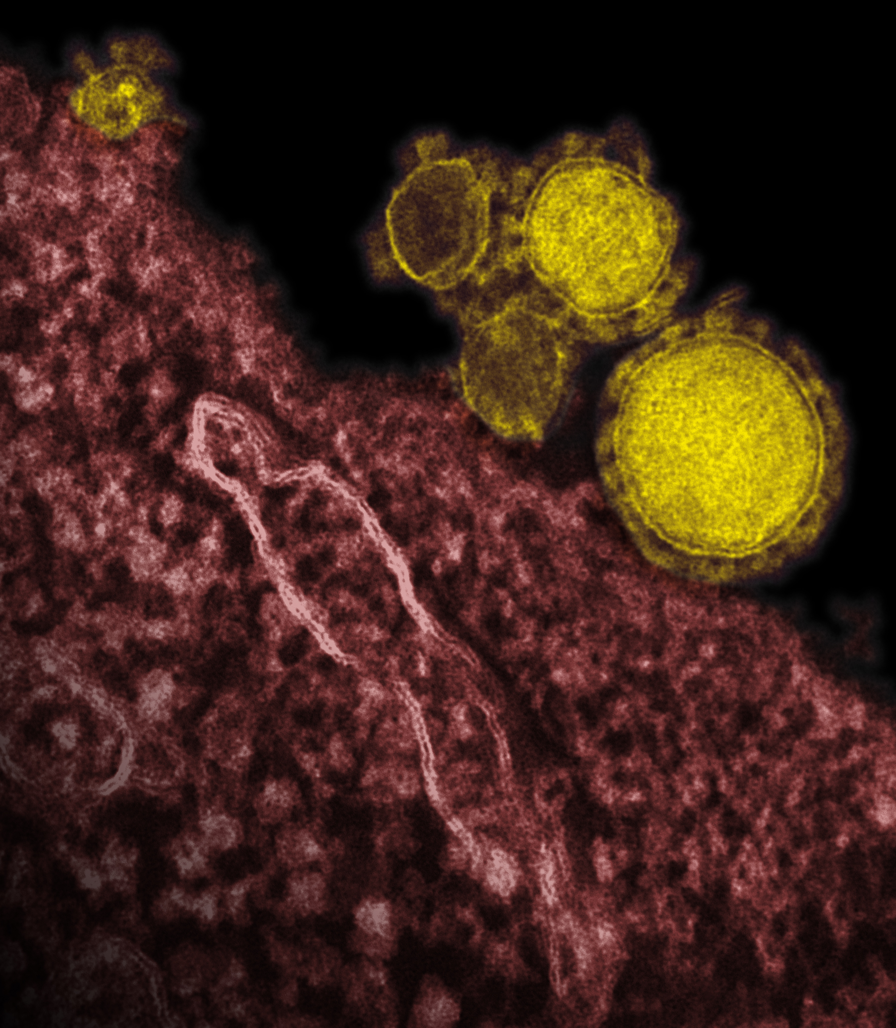 MERS-CoV, the virus that causes Middle East respiratory syndrome