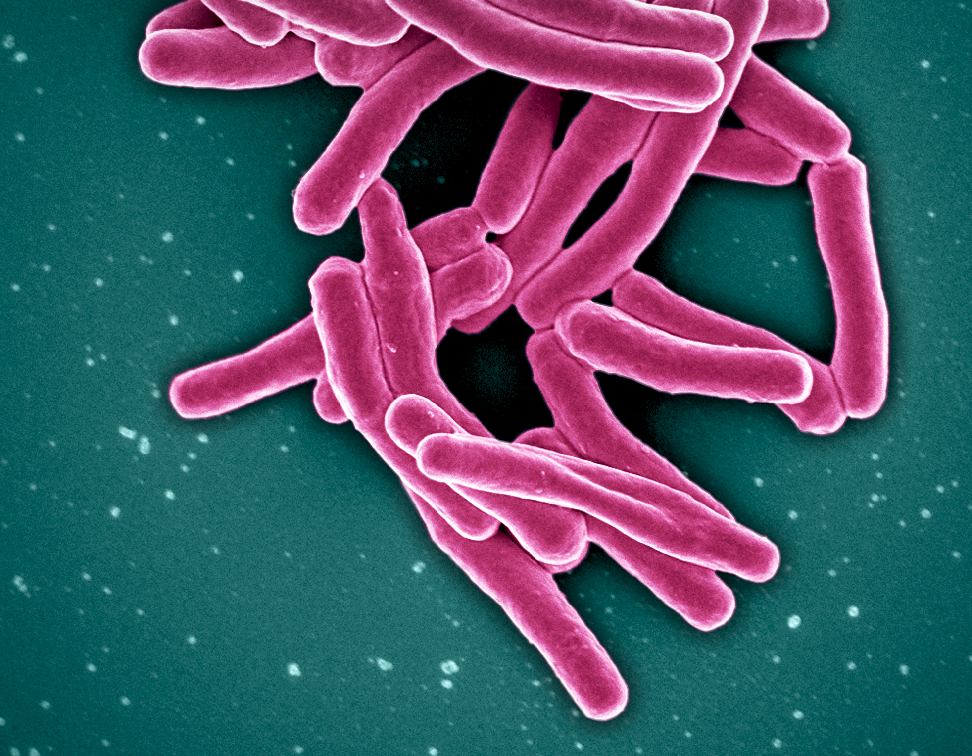 Mycobacterium tuberculosis bacteria, cause of the infectious disease tuberculosis