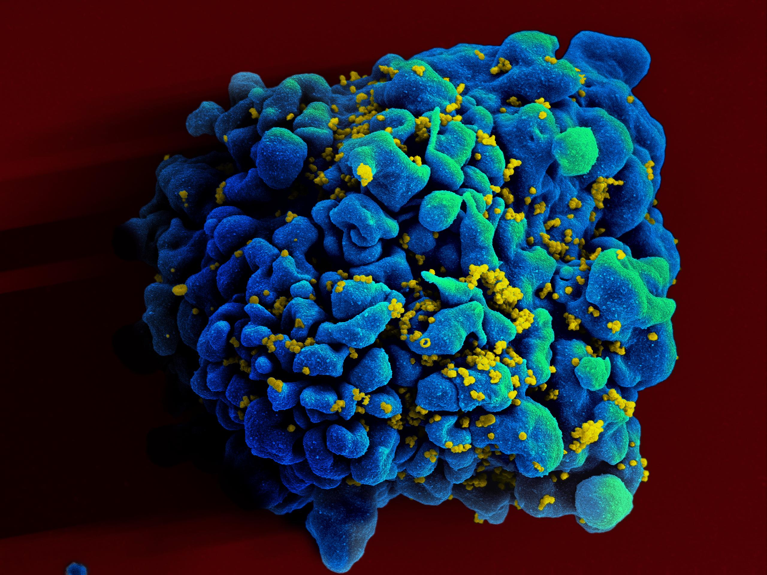 Cell infected with HIV