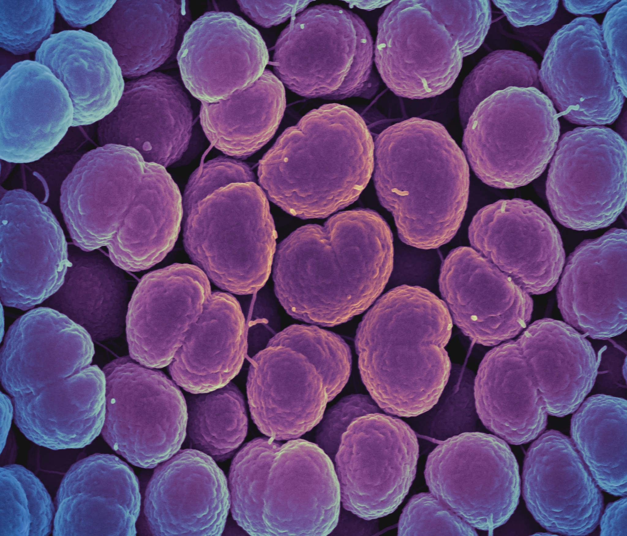 Neisseria gonorrhoeae bacteria, cause of the sexually transmitted disease gonorrhea