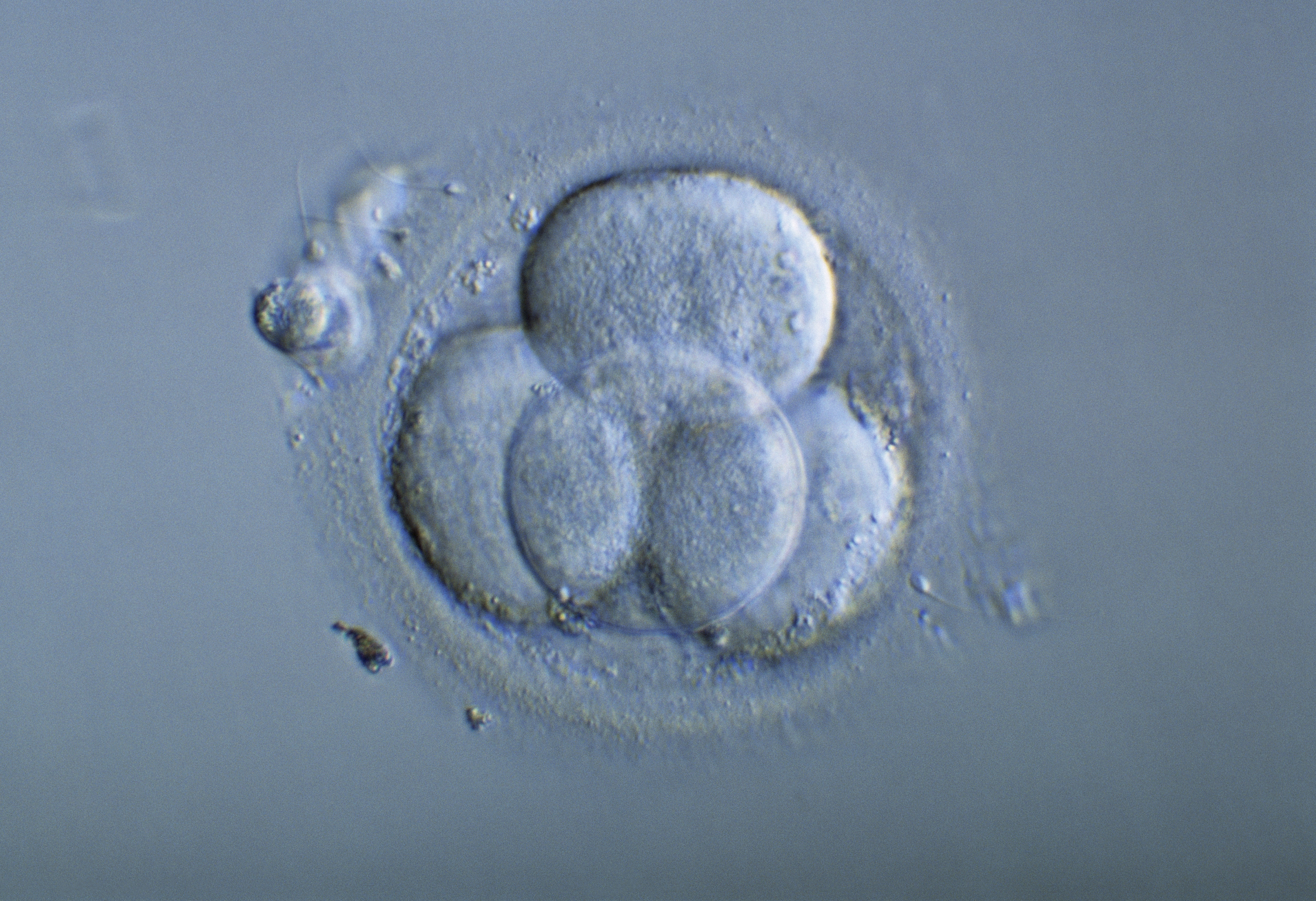 Human embryo